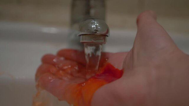 Cleaning bleeding hand after accident in sink