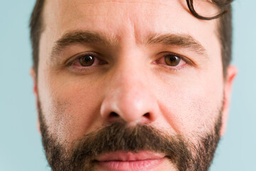 Obraz premium Depressed man with an eye infection