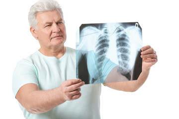 Senior man with x-ray image of lungs on white background