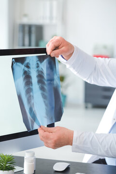 Pulmonologist with x-ray image of lungs in clinic