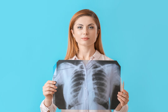 Woman with x-ray image of lungs on color background