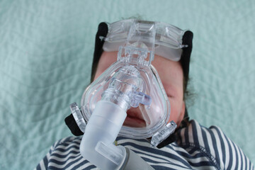 Baby wearing a mask for use with a nebuliser.  paediatric respiratory disease concept represented...