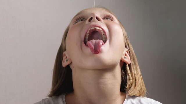Cute school-age girl at an appointment with a doctor, a jaw surgeon or an orthodontist. Child opens his mouth wide and sticks out his tongue for inspection. Close-up