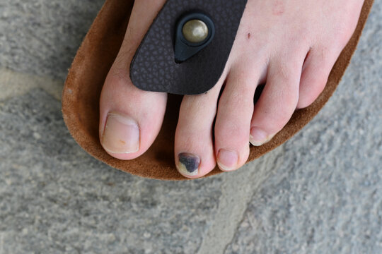 piedi unghia nera unghie lunghe pedicure 