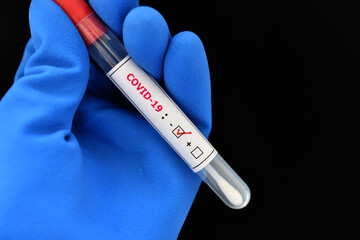 Naklejka premium Nasopharyngeal swab negative with COVID-19 test by using RT-PCR method