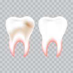 White tooth and with yellow plaque, teeth whitening and cleaning concept, vector illustration.