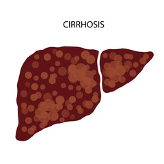 Liver disease concept