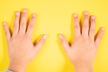 manos con fondo amarillo solido