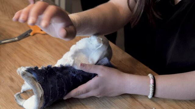 A girl removes the cast from her arm after six weeks. She's being filmed by her friend. The arm is dry and wrinkled and the girl feels, looks and compares her arms.