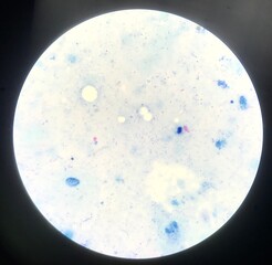 Bacteria cell in Gram stain.