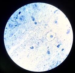 Bacteria cell in Gram stain.