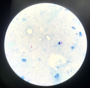 Bacteria cell in Gram stain.