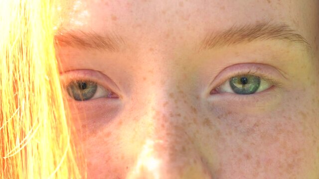 Blue-gray eyes of a young woman with red hair and freckles in bright sunlight. Natural beauty with freckles