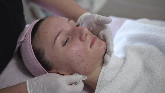 Beautician applying moisturising vitaminic gel on teen girl's problematic acne skin in spa salon, close up