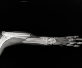 Dog leg fracture xray. Canine radius and ulna limb fracture radiograph