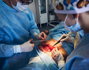 Medical workers in sterile gloves performing plastical surgical operation. Doctors wearing surgical...