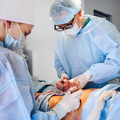 Medical workers performing plastical surgical operation in operating room. Plastic surgeon and...
