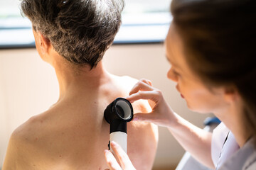Dermatologist Checking Skin Allergy - obrazy, fototapety, plakaty