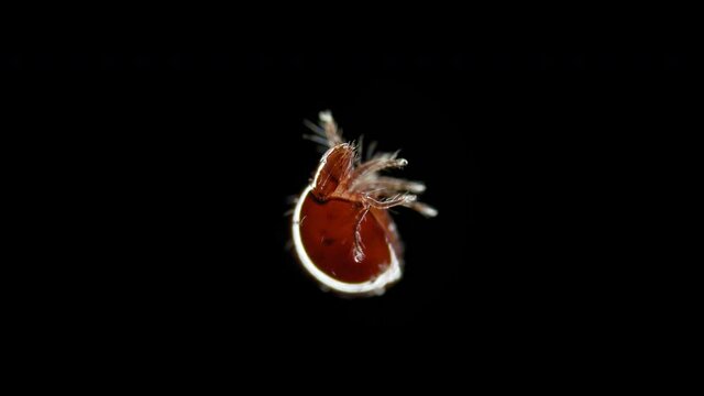 mite (acari) Oribatida under a microscope, Suborder Mixonomata. In case of danger, he draws in his legs and covers himself with his head like a shield. Sample found in moss