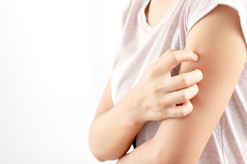 Obraz na płótnie Canvas Woman itchy arm due to allergy to skin lotion.
