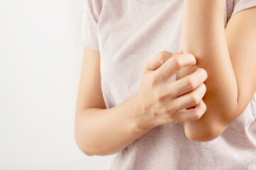 Woman itchy arm due to allergy to skin lotion.