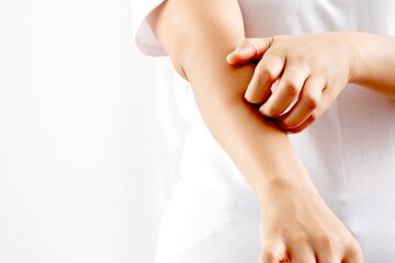 Woman itchy arm due to allergy to skin lotion.