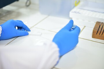 Hand medical tecnologist testing covid-19 antigen positive.