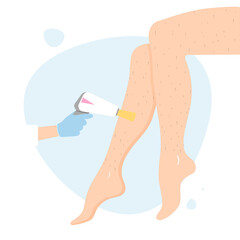 Laser hair removal of the legs and body