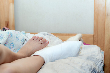Fototapeta na wymiar The girl has a broken leg. Woman resting at home in bed after medical treatment. Human leg in a cast on the bed.
