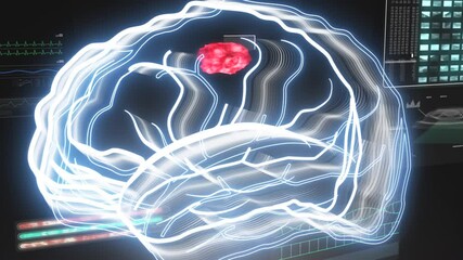 Brain scanned cancer tumor detected. Brain tumor, disease, medical exam, modern xray, neural modern cancer detection, 3D animation
