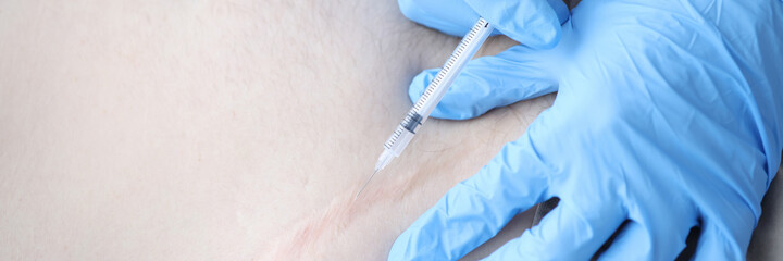 Nurse injecting medicine into patients postoperative scar closeup