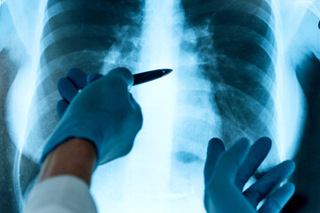 close up. medical colleagues discussing an x-ray of the lungs .