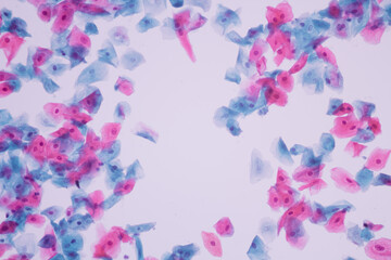 Normal squamous epithelial cells of cervical human view in microscopy.Cytology criteria from pap smear.Medical background concept.