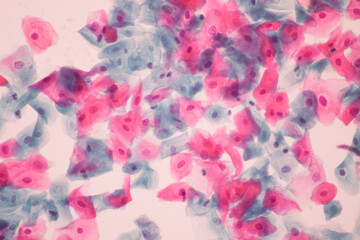 Fototapeta na wymiar Normal squamous epithelial cells of cervical human view in microscopy.Cytology criteria from pap smear.Medical background concept.