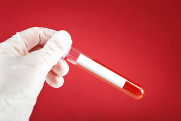 Hand holding test tube with blood plasma ready for testing. Medicine, test, tests, blood. On a red background.