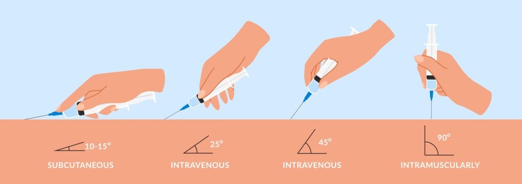 Types injections. Guide to injecting vaccines into skin. Hands holds syringes at different angles. Doctors' arms vaccinate patients. Vector medical procedure manuals for hospital workers