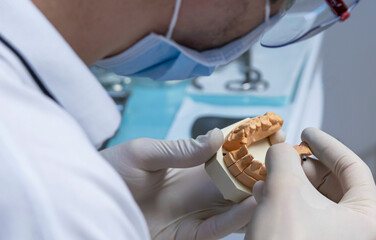 Dental prosthesis for implant.