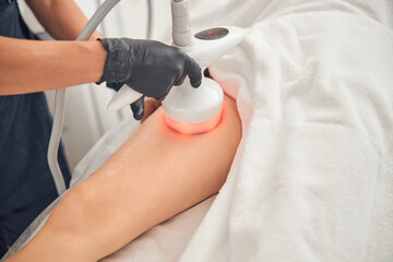 Woman getting relifting treatment on her legs