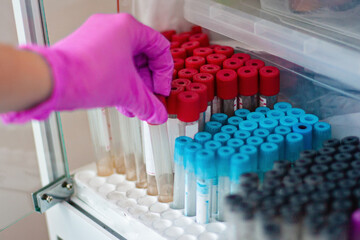 Selective focus Hands in medical gloves sort through test tubes