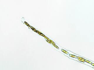 Diatom algae under microscopic view, freshwater