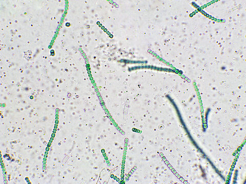 Nostoc sp. algae under microscopic view, Cyanobacteria, Blue green algae