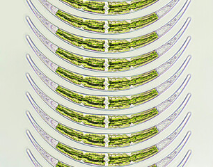 Closterium sp. - Charophyta algae under microscopic view x40, Green algae
