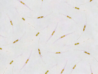 Cylindrotheca sp. algae under microscopic view, diatoms