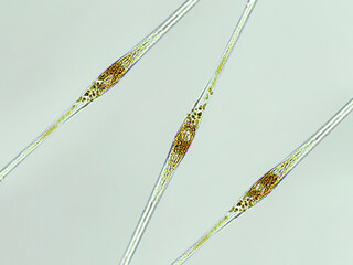 Cylindrotheca sp. algae under microscopic view, diatoms