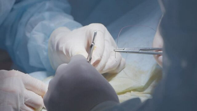 Surgeons apply stitches. Action. Applying surgical sutures to patient under anesthesia. Surgeons professionally and carefully apply stitches after serious operation