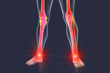 Foot and ankle pain, 3D illustration. Foot anatomy