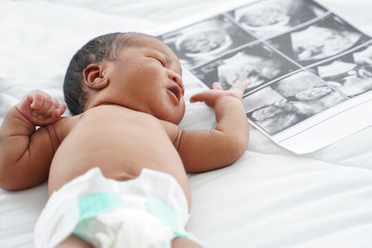 Portrait of African new born baby  with diaper lying on bedroom with fetal ultrasound image for pregnancy. White background