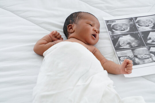 Portrait of African new born baby  with blanket lying on bedroom with fetal ultrasound image for pregnancy. White background