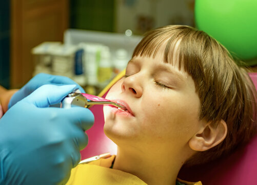 The dentist is carrying out the sanitation of the boy's oral cavity. Children stomatology.