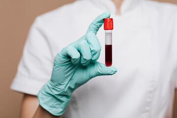 Nurse holding a blood test tube - obrazy, fototapety, plakaty